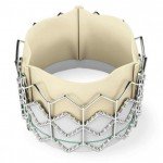 Sapien transcatheter aortic valve