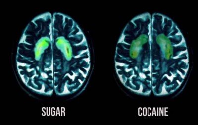 brain2