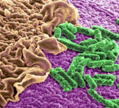 gut-bacteria22