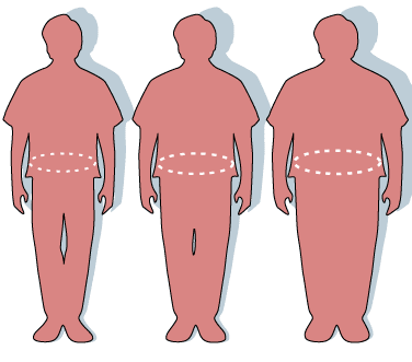 obesity waist circumference